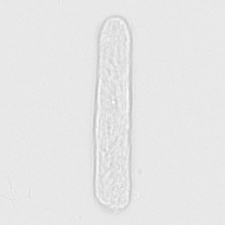 Цилиндры гиалиновые