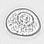 Переходный (базальный)