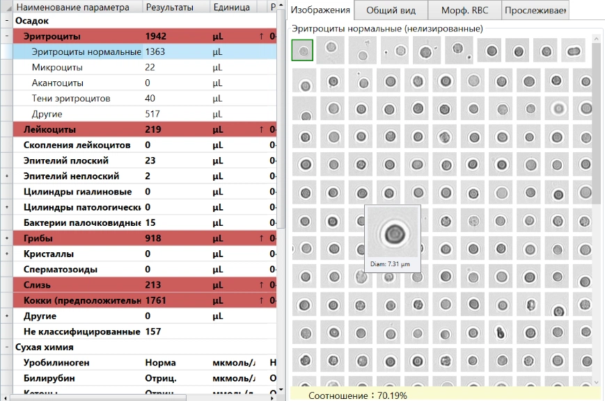 Интерфейс результатов микроскопии осадка